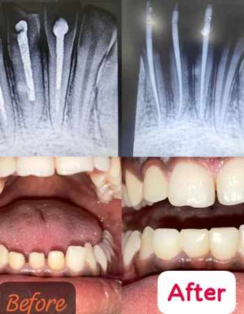 Dr.Anu’s Tooth Care Dental Clinic