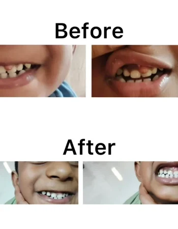 Dr.Anu’s Tooth Care Dental Clinic